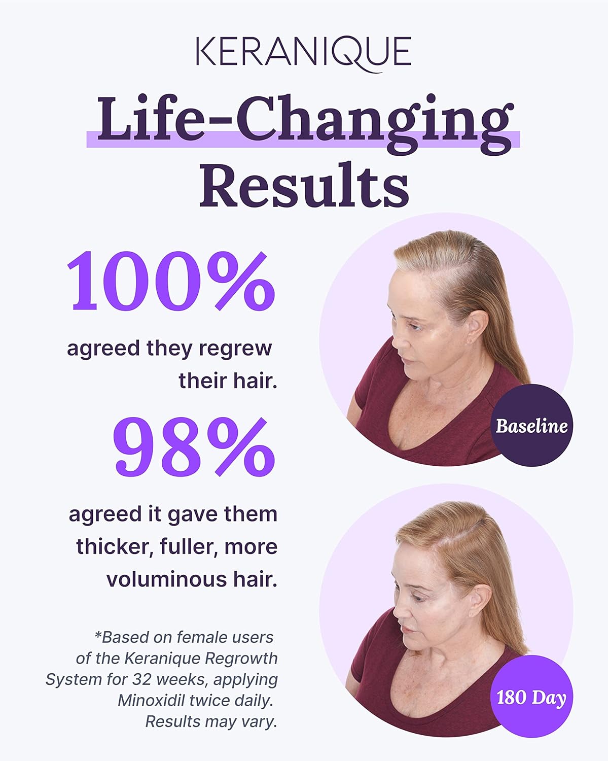 Volumizing Shampoo, Conditioner, and Regrowth Treatment Bundle with Biotin, Keratin, and Minoxidil Spray A3367